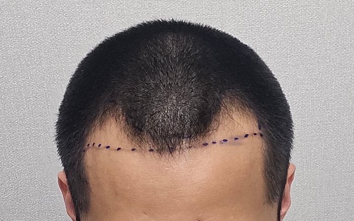 3.디자인후.jpg