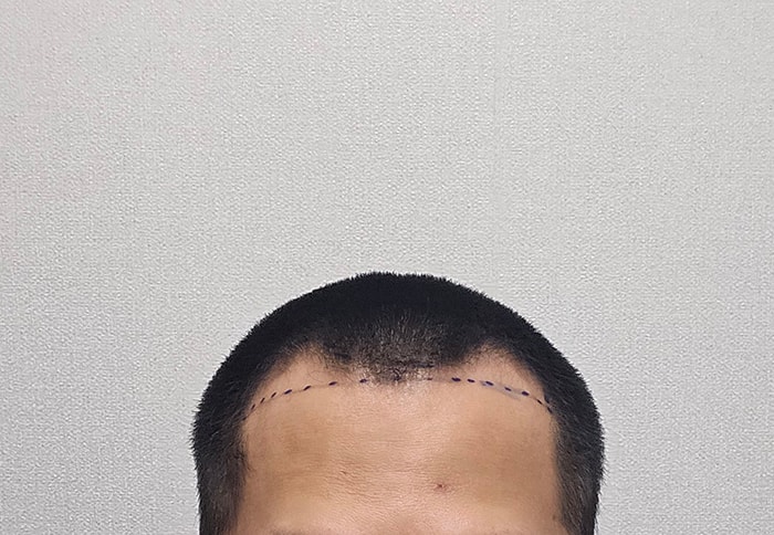 2.디자인후.jpg