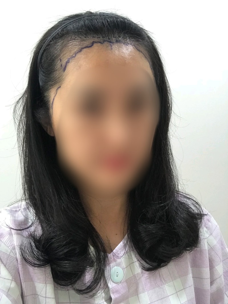 BlurImage_1-9-2019-9-24-34.jpg