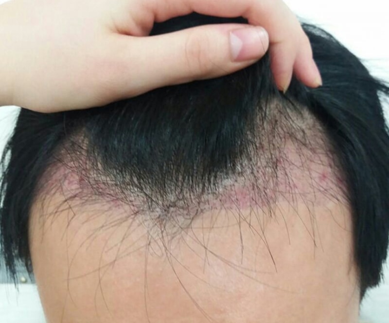 암흑기.jpg