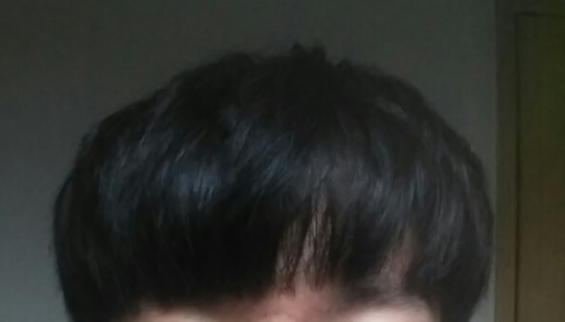 수술전.jpg