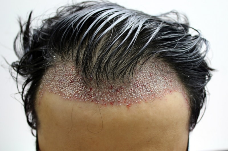 수술후5.jpg