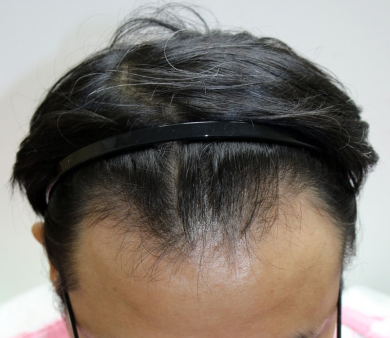 ついにポヘアから1200毛包の前の町に引っ越しました^^