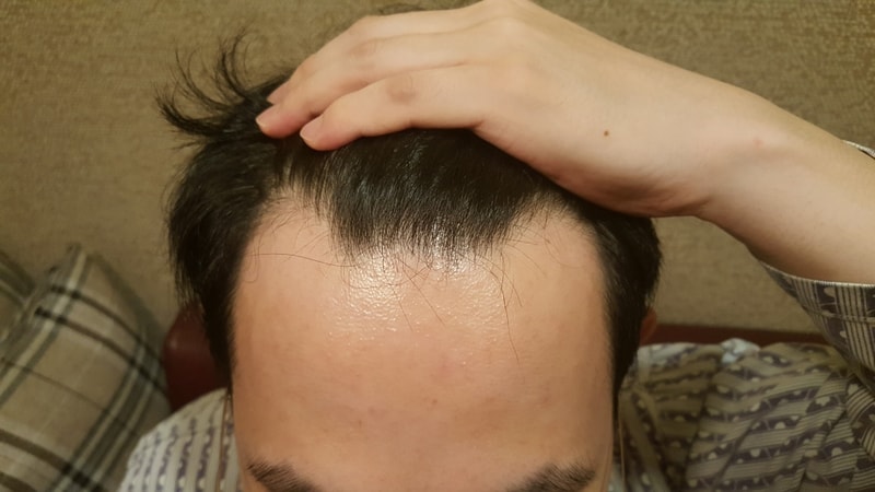 20180821_083641.jpg