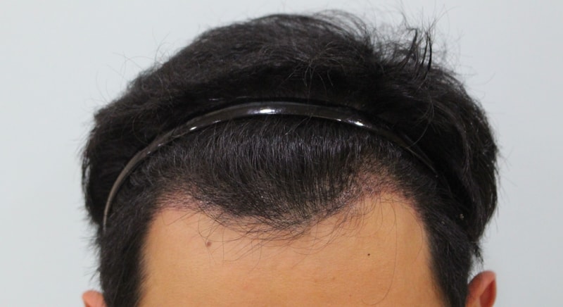 10일후.jpg