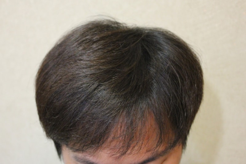 수술후 (1).jpg