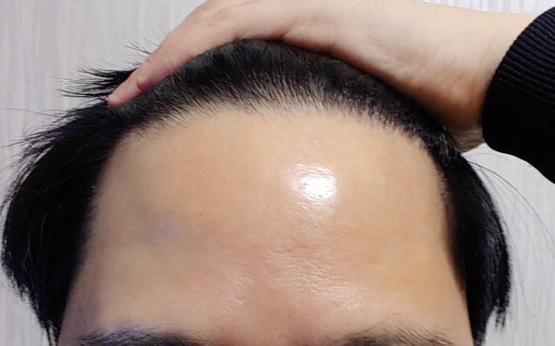 12개월 정면.png
