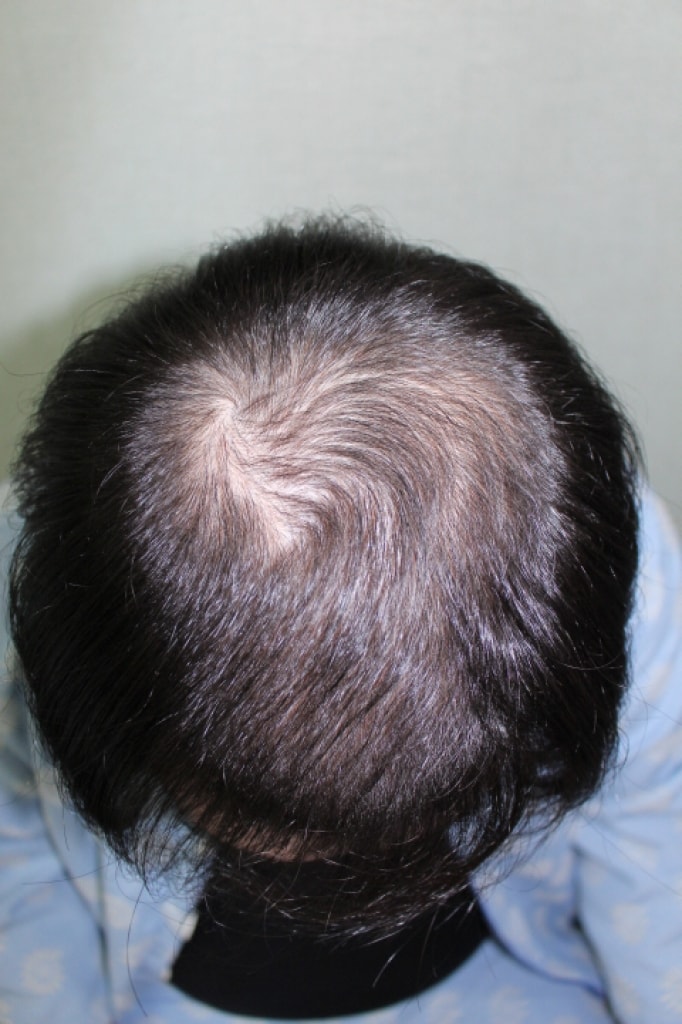 Anyang Eve's top of the head is 5,400mo. It's been 6 months