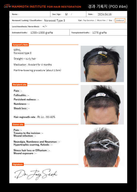 It is a review after 4 months of non-excision. Diamond Slit Hair Transplantation Review