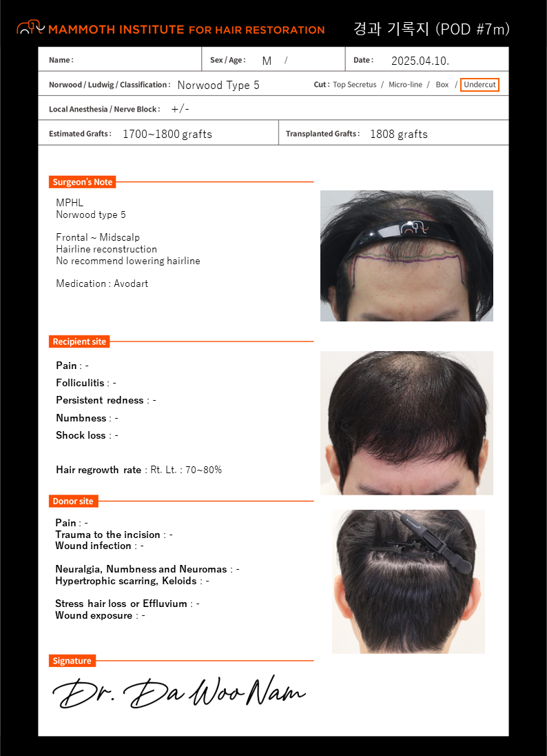 포토후기 이미지