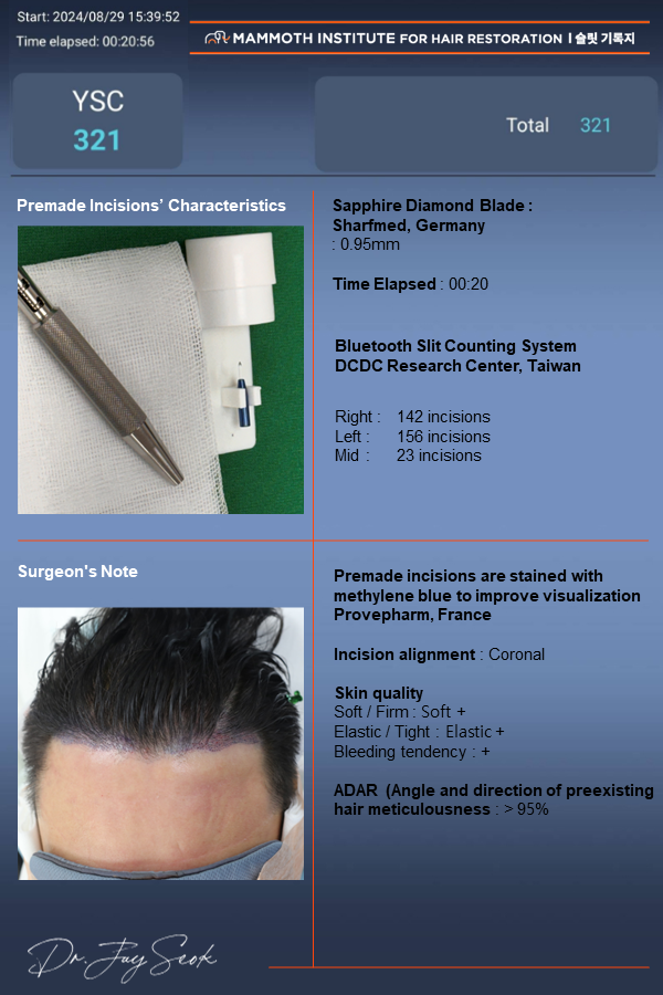 4th reoperation of hair transplant. This is the review of the day of the GOAT Apgujeong mammoth.