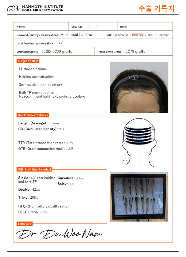 포토후기 이미지