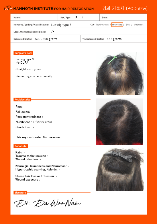 Leave a review of top of the head hair loss non-cut hair transplantation. Thank you Mammoth Nam Dow.