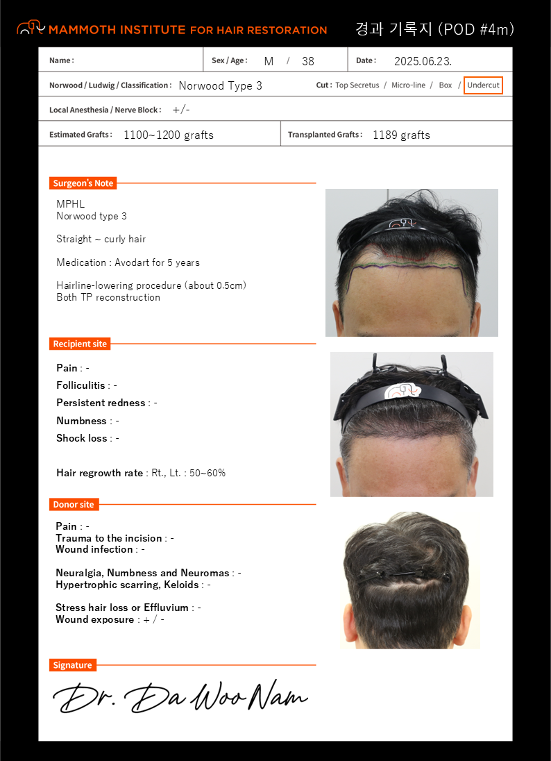 포토후기 이미지