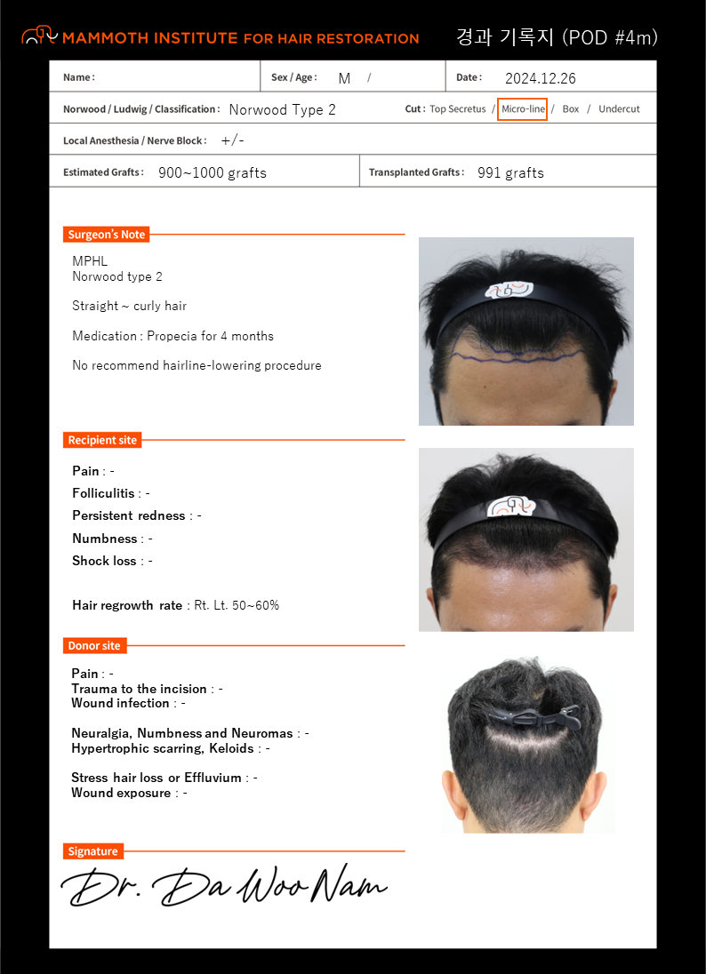 Slit non-cut hair transplant day~4 months late "Apgujeong Mamos Nam Dawoo Director"