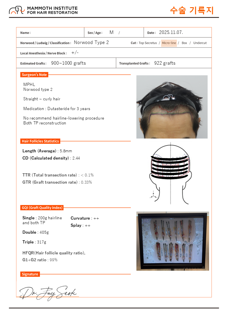 블루투스 슬릿 모발이식 수술 후기