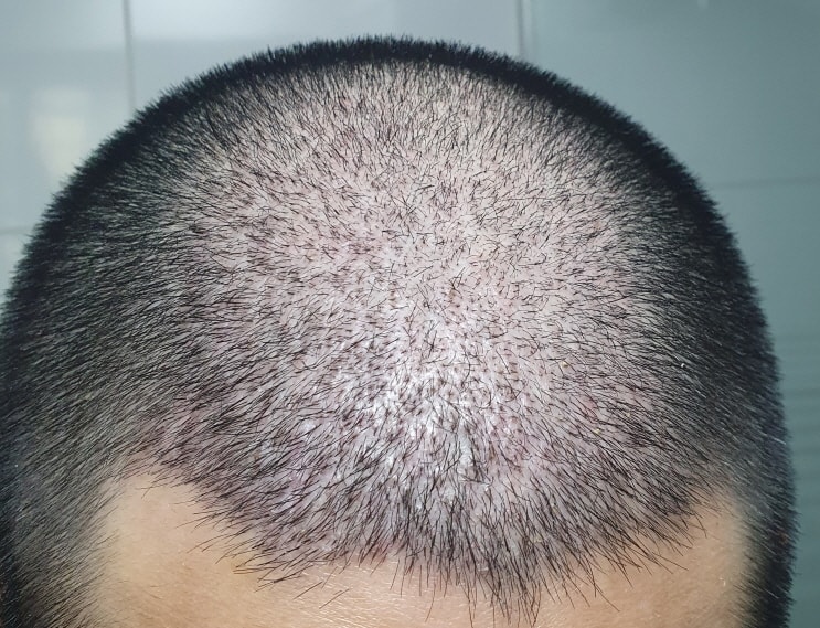 사본 -1205샤워.jpg