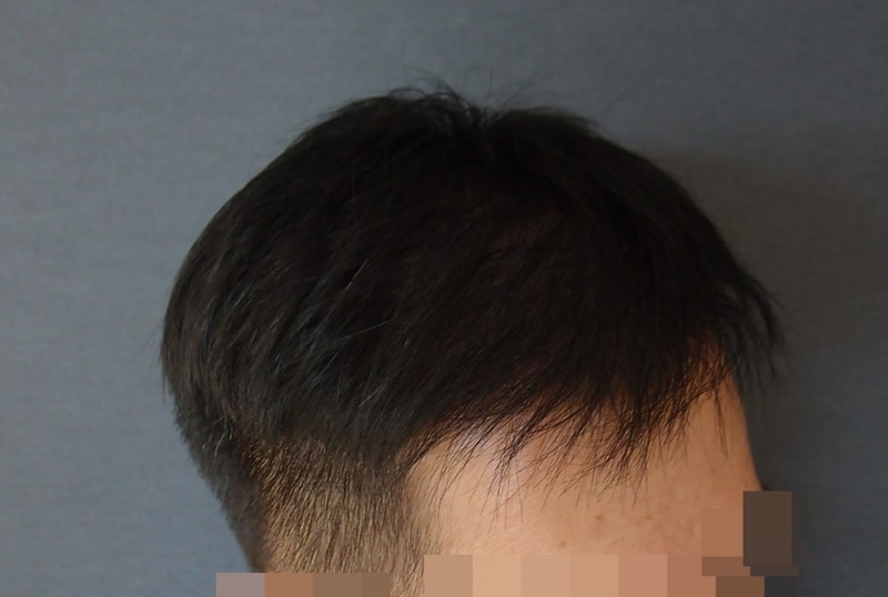 수술후2.jpg