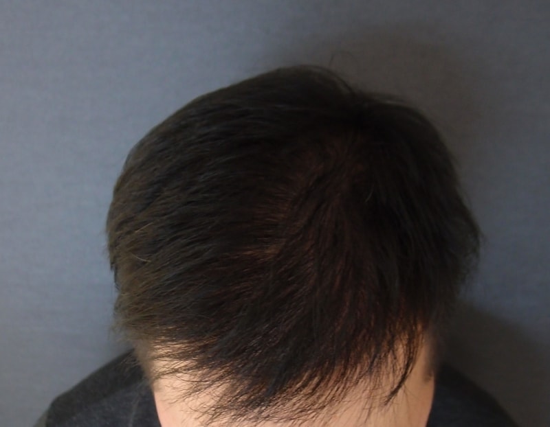수술후1.jpg
