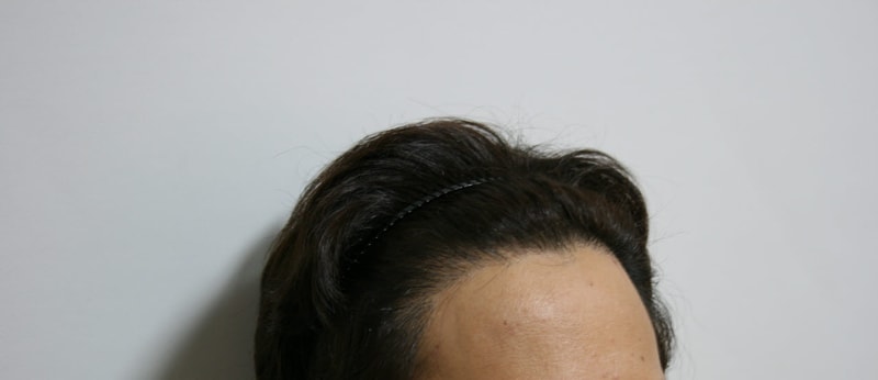후2.jpg