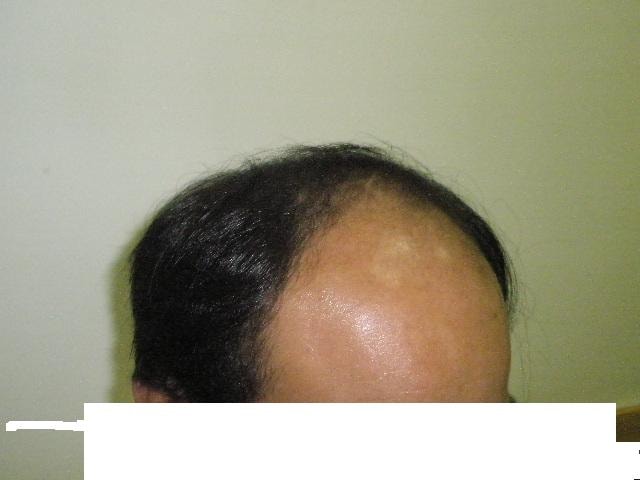 수술전2.JPG