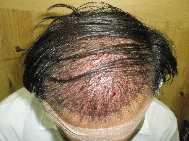 수술후1.JPG