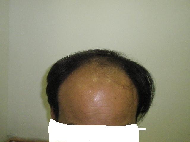 수술전1.JPG