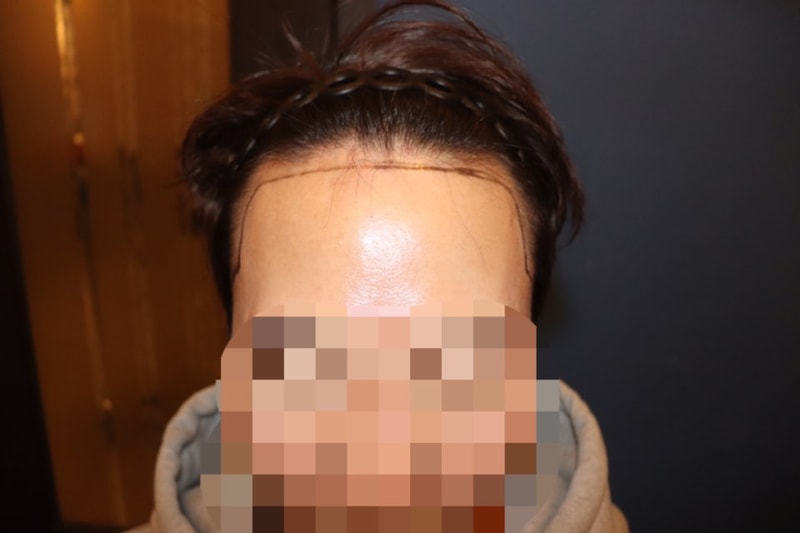 초진_정면.jpg