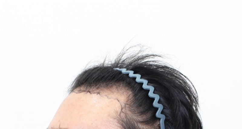 포토후기 이미지