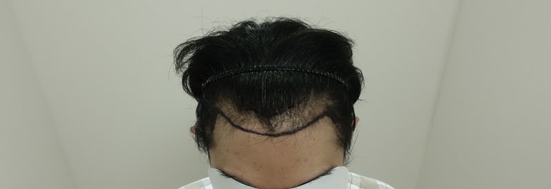 수술전4.jpg