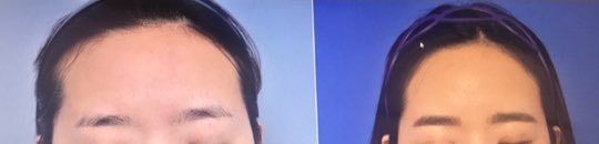 후2.jpg