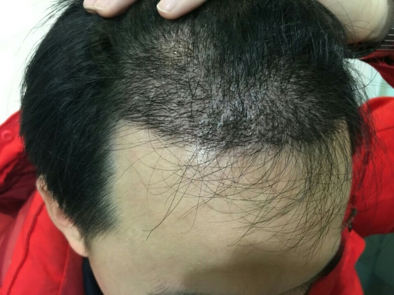 KakaoTalk_20160309_004541701.jpg