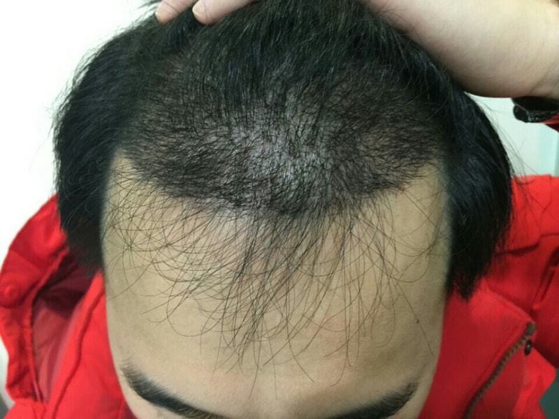 KakaoTalk_20160309_004540579.jpg