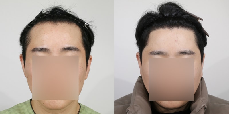 후.jpg
