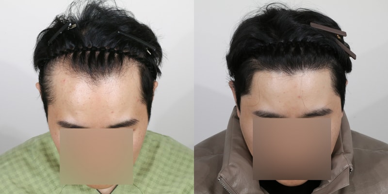 전.jpg