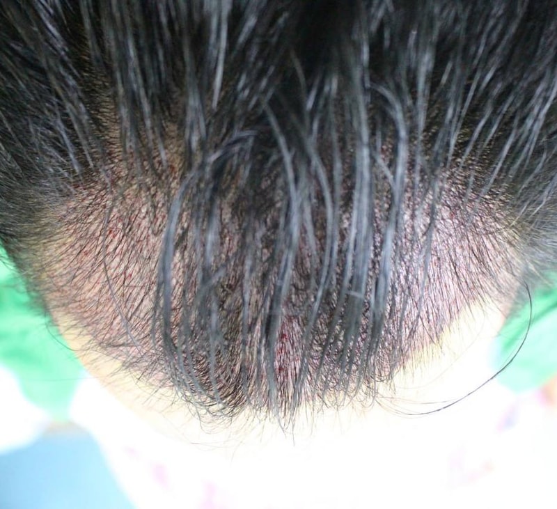 김희승술후2.jpg