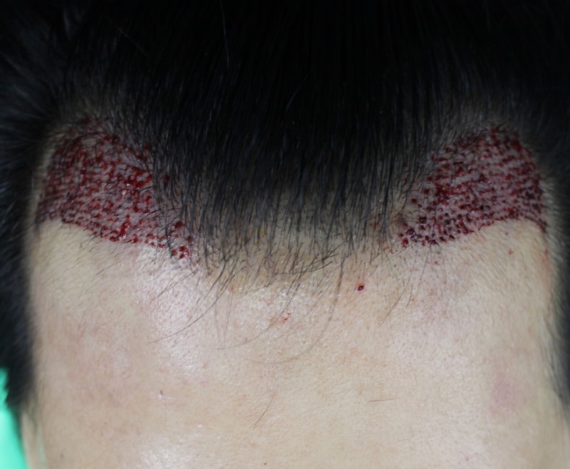 김명기-술후12.jpg