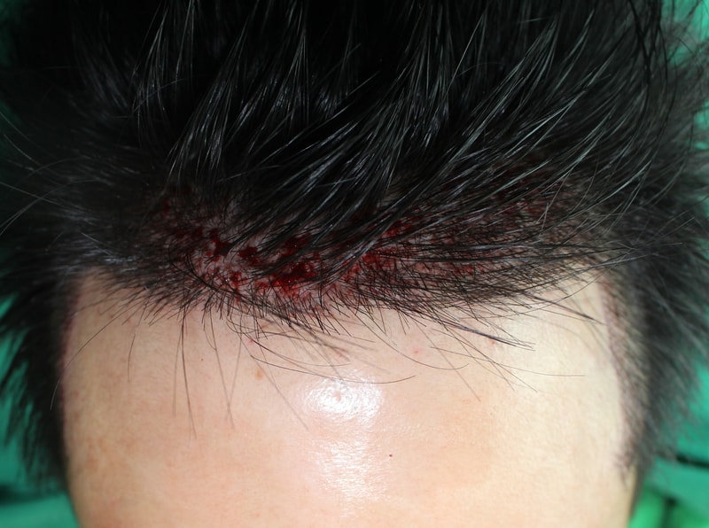 김현민-술후1.jpg