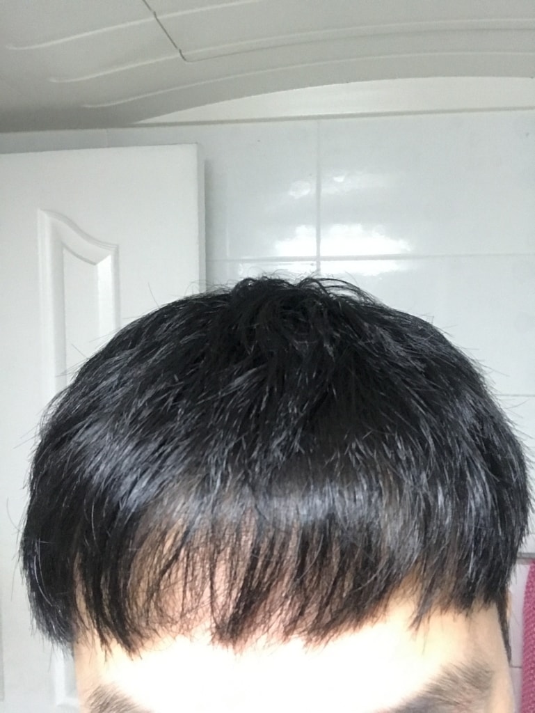 2년차정면.JPG