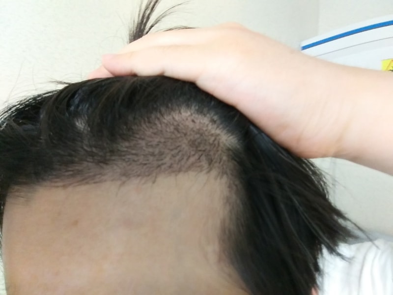 17일차 좌측.jpg