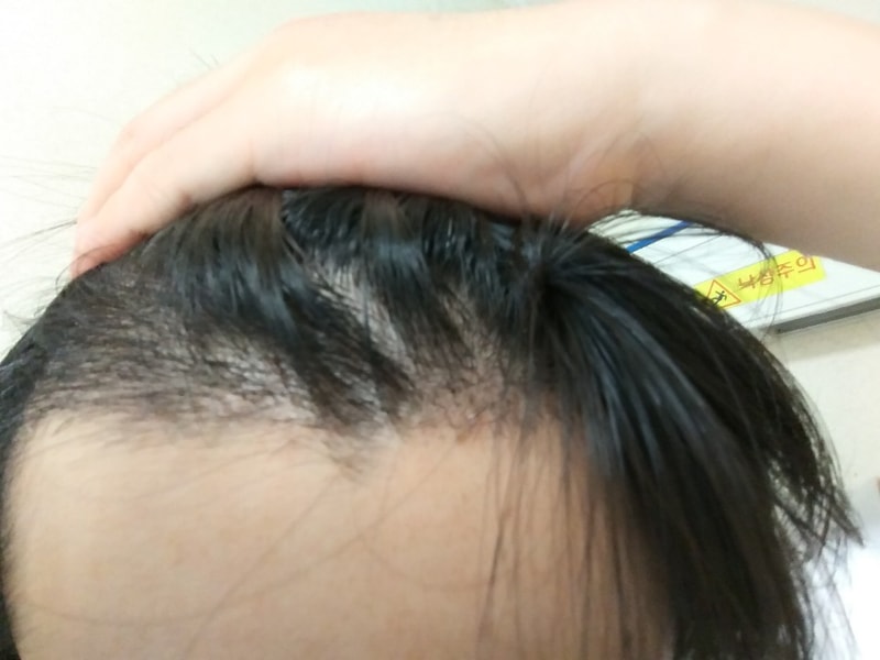 17일차 우측.jpg