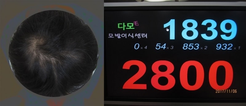 이식기타.jpg