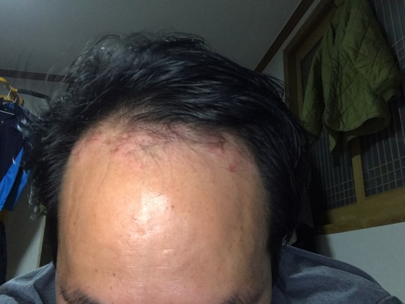 KakaoTalk_20170712_205123148.jpg