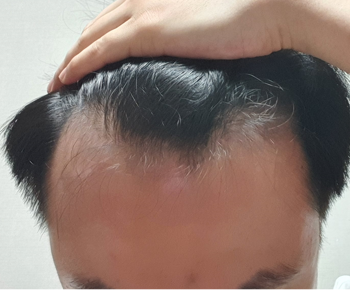 모발3.png