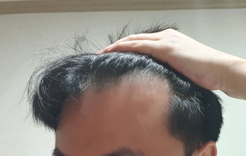 모발2.png