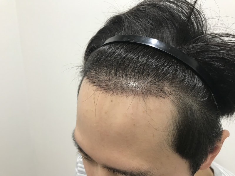 KakaoTalk_20180308_200856419.jpg