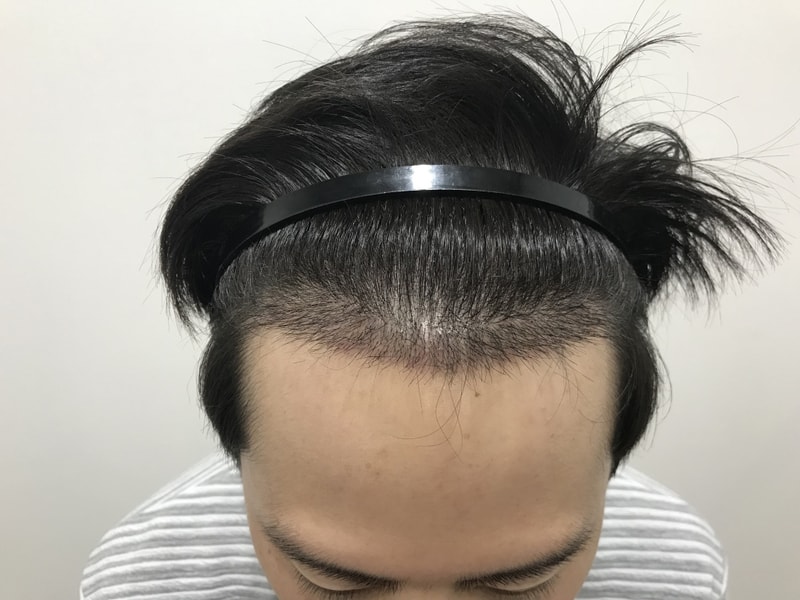 KakaoTalk_20180308_200858310.jpg