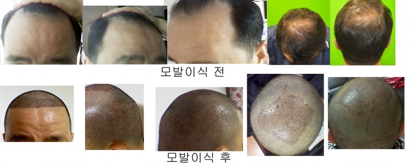 모발.jpg