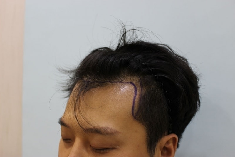수술전4.jpg