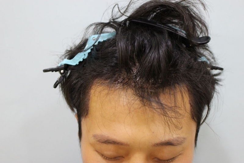 다음날샴푸후2.jpg